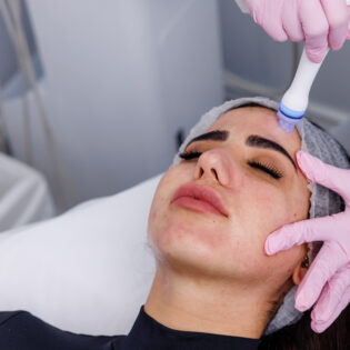 The Super Facial Package of 4 Treatments