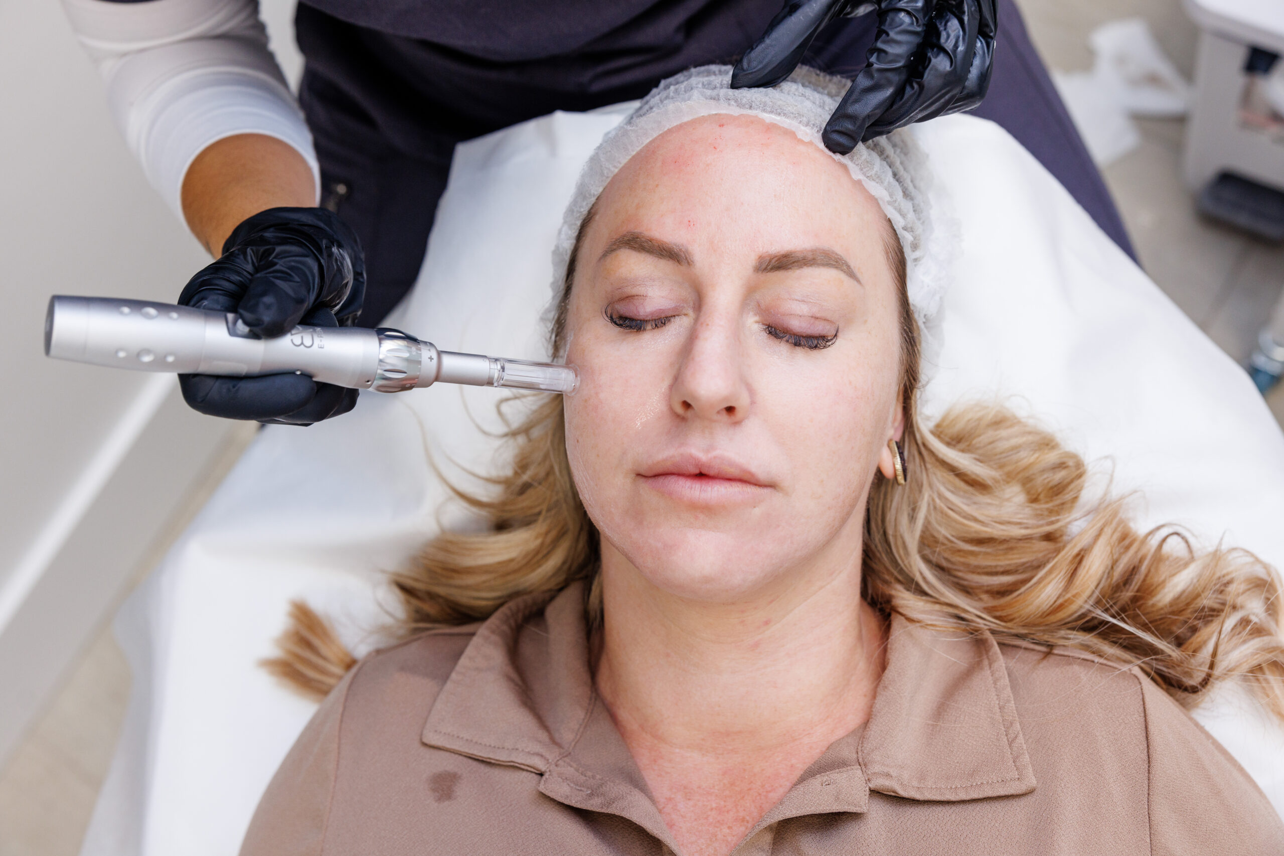 Microneedling Package of 4 Treatments